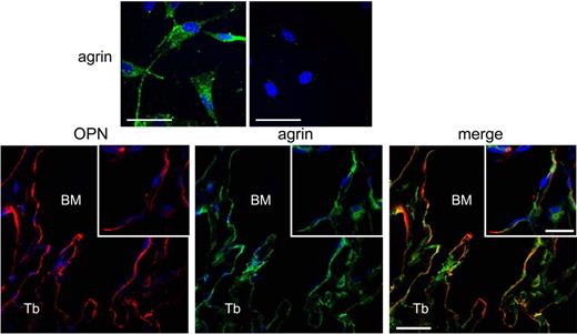 Top panels: Primary endosteal MSCs express agrin (from Figure 2A, Mazzon et al1). Bottom panels: In vivo endosteal ostepontin-expressing cells of the osteoblastic lineage express agrin (from Figure 1A, Mazzon et al1).