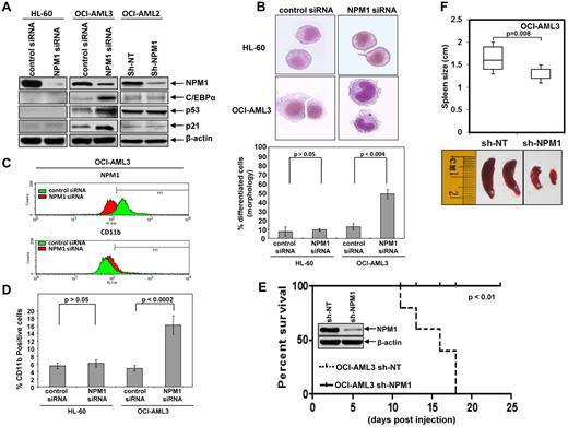 Figure 2. Depletion of NPM1 induces differentiation of mutant NPM1 expressing AML cells and abolishes OCI-AML3 cell-induced AML in NOD/SCID mice. (A) HL-60, OCI-AML3, and OCI-AML2 cells were transfected with control or NPM1 siRNA and incubated for 72 hours. Then, immunoblot analyses were performed for NPM1, C/EBPα, p53, and p21 on the total cell lysates. The expression of β-actin in the lysates served as the loading control. (B) Top panel, representative light microscopic images of HL-60 and OCI-AML3 cells transfected with control or NPM1 siRNA for 96 hours. Bottom panel, 96 hours post transfection, control and NPM1 siRNA transfected HL-60 and OCI-AML3 cells were cytospun onto glass slides, Wright-Giemsa stained and the percentage of differentiated cells was determined by light microscopy. Values represent the mean of 3 independent experiments ± SEM. (C) OCI-AML3 cells were transfected with control or NPM1 siRNA for 96 hours. At the end of treatment, cells were fixed, permeabilized and stained with DyLight 647-conjugated anti-NPM1 antibody followed by flow cytometry. For determination of CD11b expression, cells were washed with 1X PBS and stained with anti-CD11b antibody. Representative flow histograms of NPM1 and CD11b expression levels are presented. (D) OCI-AML3 cells were transfected with control or NPM1 siRNA for 96 hours. Then, cells were washed and stained with CD11b antibody and the percentages of CD11b positive cells were determined by flow cytometry. Values represent the mean percentage of CD11b positive cells from 3 independent experiments ± SEM. (E) Female NOD/SCID mice were irradiated and then injected in the lateral tail vein with OCI-AML3 sh-NT or OCI-AML3 sh-NPM1 (n = 5 mice per group). The mice were monitored daily for symptoms of leukemia. Survival of the mice in OCI-AML3 sh-NT and OCI-AML3 sh-NPM1 is represented by Kaplan-Meier plot. Median survival of the OCI-AML3 sh-NT leukemia bearing mice was 16 days. (F) When the mice were humanely killed, the spleens were collected and measured. Top panel, the box plot displays the range of spleen size from OCI-AML3 sh-NT and sh-NPM1 leukemia bearing mice. The median spleen size for OCI-AML3 sh-NT mice was 1.6 cm compared with 1.2 cm in the OCI-AML3 sh-NPM1 mice. Bottom panel, representative images of the spleens from 2 OCI-AML3 sh-NT and sh-NPM1 leukemia bearing mice are shown.