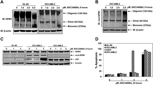 Figure 5. Small molecule inhibitor NSC348884 disrupts NPM1 oligomerization and induces apoptosis in OCI-AML3 cells. (A) HL-60 and OCI-AML3 cells were treated with the indicated concentrations of NSC348884 for 8 hours. After this, total cell lysates were prepared and native gel electrophoresis and immunoblot analysis of NPM1 was performed to assess the disruption of NPM1 oligomerization. The expression levels of β-actin in the lysates served as the loading control. (B) OCI-AML3 cells were treated with the indicated concentrations of NSC348884 for 8 hours. After this, total cell lysates were prepared and native gel electrophoresis and immunoblot analysis of mutant NPM1 was performed to assess the disruption of mutant NPM1 oligomerization. The expression levels of β-actin in the lysates served as the loading control. (C) HL-60, OCI-AML3, and OCI-AML2 cells were treated with indicated concentrations of NSC348884 for 8 hours. After this, total cell lysates were prepared and immunoblot analyses were performed for NPM1, Mt-NPM1 and p53. The expression levels of β-actin in the lysates served as the loading control. (D) HL-60, OCI-AML3, U937, and OCI-AML2 cells were treated with the indicated concentrations of NSC348884 for 24 hours. Then, cells were stained with annexin V and propidium iodide and the percentages of apoptotic cells were determined by flow cytometry. Columns represent the mean of 3 independent experiments; bars represent the SEM.