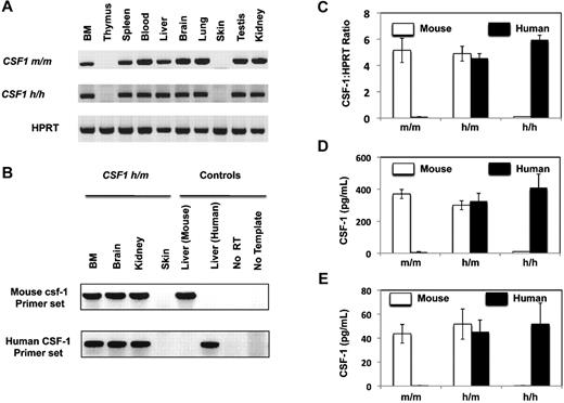 Figure 1. Expression of human CSF-1 in the humanized CSF-1 mice. (A) Indicated organs from CSF1m/m and CSF1h/h were isolated, RNA was extracted- and reverse transcription (RT)–PCR analysis was performed either using mouse CSF-1 (top) or human CSF-1 (middle) specific primers. HPRT levels (bottom) was used as controls for the input cDNA. Data are representative of 2 independent experiments. (B) Indicated organs from CSF1h/m were isolated, RNA was extracted and RT-PCR analysis was performed either using mouse CSF-1 (top) or human CSF-1 (bottom) specific primers. RNA extracted either from mouse liver or human fetal liver served as positive controls for mouse and human primer pairs, respectively, no RT, and no template PCR reactions served as negative controls. Data are representative of 2 independent experiments. (C) Bone Associated Stromal Cells from CSF1m/m, CSF1h/m, and CSF1h/h mice were isolated and cultured in vitro for 10 days. Cells were lysed, RNA was extracted, and real-time PCR analysis was performed using either mouse CSF-1 (white) or human CSF-1 (black) specific primers. Shown are the mean values of duplicate samples. Error bars indicate ± SEM. Input cDNA quantity was normalized according to HPRT (hypoxanthine guanine phosphoribosyl transferase) expression levels. Data are representative of 2 independent experiments. (D) Bone Associated Stromal Cells from CSF1m/m, CSF1h/m, and CSF1h/h mice were isolated and cultured in vitro for 10 days. Cell culture supernatants were collected and the secreted levels of mouse (white) and human (black) CSF-1 were quantified using species specific CSF-1 ELISA kits. Shown are the mean values of triplicate samples. Error bars indicate ± SEM. Data are representative of 2 independent experiments. (E) CSF1m/m, CSF1h/m, and CSF1h/h mice were bled and the serum levels of human and mouse CSF-1 were quantified through ELISA. Shown are the mean values of triplicate samples. Error bars indicate ± SEM.