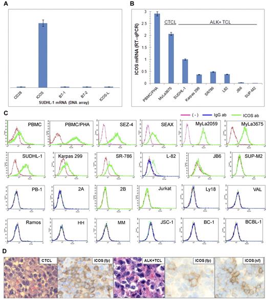 Figure 1. ICOS expression in ALK+ TCL cells. (A) The relative expression of ICOS, CD28, and their ligands by SUDH-L1 cells detected by genome-scale DNA oligonucleotide array. (B) Expression of ICOS mRNA determined by quantitative RT-PCR in the depicted ALK+ TCL cell lines compared with a CTCL cell line (MyLa3675) and mitogen-stimulated PBMCs (PBMC/PHA). (C) Expression of the ICOS protein determined by flow cytometry on ALK+ TCL- and other TCL-derived cell lines and control cell populations. (Topmost panel) Normal PBMC, PBMC/PHA, and CTCL-derived cell lines. (Top middle panel) ALK+ TCL cell lines. (Bottom middle panel) Cell lines from a progressive primary cutaneous CD30+ lymphoproliferative disorder (PB-1, 2A, and 2B), T-cell lymphoblastic lymphoma (Jurkat), and germinal center-derived diffuse large B-cell lymphoma (Ly18 and VAL). (Bottom panel) Cell lines from Burkitt lymphoma (Ramos), EBV-mediated B-cell transformation (HH and MM), and Kaposi sarcoma virus-associated body cavity lymphoma (JSC-1, BC-1, and BCBL-1). These results are representative of at least 2 independent experiments. (D) Expression of ICOS in CTCL (left panels) and ALK+ TCL (middle and right panels) tissues (original magnification ×400). Microscope: Olympus BX 40; objective: Plan Apox/0.95; camera: Leica DFC 420; software: Leica DFC Twain 6.9.0 and Microsoft Office PowerPoint 2003. Biopsy tissue sections were either formalin-fixed, paraffin-embedded (fp) or snap-frozen (sf) and stained with hematoxylin and eosin or anti-ICOS antibody.