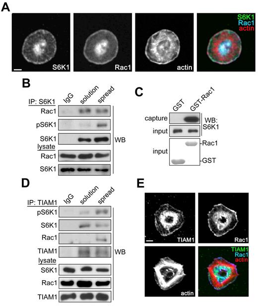 Figure 2. S6K1 and Rac1 localize to the lamellipodial edge of spreading platelets. (A) Purified human platelets were spread on coverglass coated with 25 μg/mL fibrinogen. After 45 minutes, platelets were fixed, stained for S6K1, Rac1, and actin, and visualized by confocal microscopy. Scale bar = 2 μm. (B) S6K1 was immunoprecipitated (IP) from lysates of quiescent platelets in solution or platelets spread on fibrinogen and analyzed for coprecipitating Rac1 by Western blot. Nonspecific rabbit immunoglobulins (IgG) were used as negative control for immunoprecipitations. Total S6K1 and Rac1 levels in whole-platelet lysates serve as input controls. (C) Platelet lysates were incubated with GST or Rac1-GST glutathione sepharose and captured S6K1 was analyzed by Western blot. Coomassie-stained GST and Rac1-GST inputs are shown. (D) TIAM1 was immunoprecipitated from platelet lysates as above and examined for coprecipitating S6K1 and Rac1 by Western blot. (E) Localization of TIAM1, Rac1 and actin in fibrinogen-activated human platelets visualized by confocal microscopy. Scale bar = 2 μm. Western blot, IP, protein capture, and imaging results are representative of 3 independent experiments.