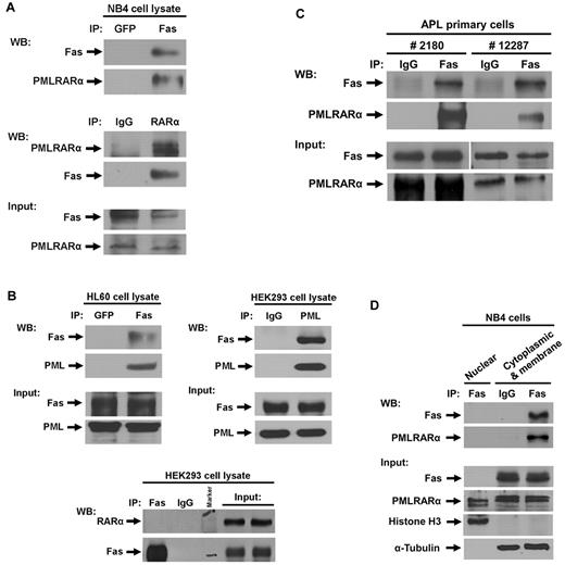 Figure 1. PMLRARα Interacts with Fas in acute promyelocytic leukemia (APL) cell line and APL primary cells. (A) Cell extracts of APL NB4 cells were immunoprecipitated using antibodies against green fluorescent protein (GFP) and Fas, or normal IgG and RARα followed by Western blot analysis with antibodies against Fas and RARα for detection of Fas and PMLRARα, respectively. The expression levels of Fas and PMLRARα in whole-cell extracts are also shown by Western blot. (B) Cell extracts of HL60 cells and HEK293 cells were immunoprecipitated using antibodies against GFP and Fas, IgG and PML, or Fas and IgG. The precipitates were subjected to immunoblot analysis using anti-Fas, anti-PML, and anti-RARα antibodies. The expression levels of Fas, PML and RARα in whole-cell extracts are also shown. (C) APL primary cells isolated from 2 patients were lysed and cell extracts were immunoprecipitated using antibodies against normal IgG and Fas. The precipitates were subjected to Western blot analysis using an anti-Fas antibody for detection of Fas, and anti-RARα antibody for detection of PMLRARα. The expression levels of Fas and PMLRARα in whole-cell extracts are shown on the bottom panels. (D) To assess location of Fas-PMLRARα complexes, APL NB4 cells were subjected to subcellular fractionation and the presence of proteins and complexes in the fractions was assessed by IP/WB analysis. Histone H3 and α-tubulin were used as nuclear and cytosol/membrane fraction control proteins, respectively.