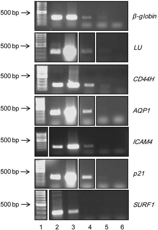 Figure 5. Genes aberrantly expressed in InLu and CDA are directly regulated by EKLF. EKLF ChIP analysis was performed using day 10 ex vivo cultured human erythroblasts. Lane 1 indicates molecular weight marker; lane 2, total genomic DNA; lane 3, positive input control DNA; lane 4, DNA precipitated with EKLF antibody; lane 5, DNA precipitated with GFP (control) antibody; and lane 6, water control. DNA was analyzed by polymerase chain reaction using primers flanking the EKLF recognition sequence of the β-globin, LU, CD44, AQP1, ICAM4, p21, and SURF1 (control) promoters. As some samples were run in a different order on gels, lanes were cut and aligned for consistency.