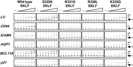 Figure 6. Binding affinity of WT and mutant EKLF for a number of EKLF-regulated genes. Saturation fluorescent gel shift assays were performed with recombinant WT, E325K, R331G, R328L, and K332Q EKLF ZF protein (0-2500nM) and 40nM Hex-labeled double-stranded oligonucleotides composed of EKLF recognition site and surrounding residues from the LU, CD44, ICAM4, AQP1, BCL11A, and p21 promoters (n = 3). Arrow indicates free Hex-labeled oligonucleotide. *Protein-DNA complexes. **Nonspecific binding or binding of EKLF to degenerate CACC sites.