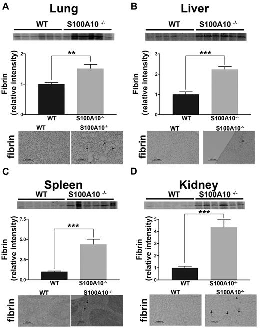 Figure 1. Loss of S100A10 results in increased tissue fibrin deposition. Lung, liver, kidney, and spleen tissues from 6 WT and S100A10−/− mice were collected, and the fibrin content of tissue lysates was determined by SDS-PAGE and Western blot analysis. A total of 10 ng of each tissue was loaded. Quantification of fibrin deposition was normalized to WT levels. Immunohistochemistry for fibrin was performed on perfused sections of formalin-fixed tissues. Sections were deparaffinized and incubated with antifibrin antibody followed by antirabbit HRP. Arrows indicate areas with fibrin deposition. Tissues observed were lung (A), liver (B), spleen (C), and kidney (D). Statistical analysis was performed with the use of Student t test, and the data are expressed as the mean (±) SEM of 6 independent experiments (**P < .01, ***P < .001). Sections were mounted by the use of Cytoseal 60 mounting media (Richard-Allen Scientific) and viewed with a 20×/0.5 NA objective lens. Images were captured by the Nikon Eclipse E600 microscope with a Nikon DXM1200F camera. Digital acquisition of the images was performed with ACT-1 Version 2.7 software (Nikon). Figures were generated with Adobe Photoshop CS3 Version 10 (Adobe Systems Incorporated).