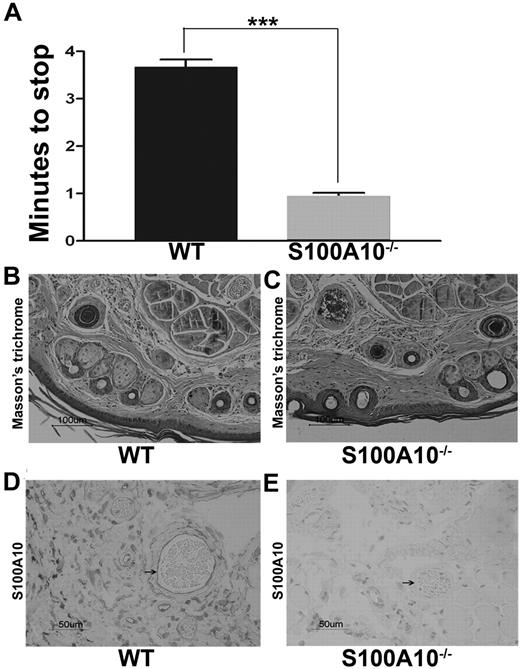 Figure 3. Bleeding time in WT and S100A10−/− mice. The last 3 mm of the tail of anaesthetized WT and S100A10−/− mice was clipped with a scalpel blade. The clipped tails of the anaesthetized mice were placed in 37°C saline, and the time for cessation of bleeding was recorded (A). Masson trichrome staining was used to observe the morphology of tail sections from WT (B) and S100A10−/− (C) mice. Immunohistochemistry for S100A10 was also performed on tail sections from WT (D) and S100A10−/− (E) mice. Sections were deparaffinized and either subjected to Masson trichrome staining or anti-S100A10 antibody followed by antigoat HRP. Arrows indicate endothelial lining of vessels. Statistical analysis was performed with Student t test, the data are expressed as (±) SEM of 3 independent experiments (***P < .001). Sections were mounted with Cytoseal 60 mounting media (Richard-Allen Scientific) and viewed with a 20×/0.5 NA objective lens. Images were captured by the Nikon Eclipse E600 microscope using a Nikon DXM1200F camera. Digital acquisition of the images was performed with ACT-1 Version 2.7 software (Nikon). Figures were generated with Adobe Photoshop CS3 Version 10 (Adobe Systems Incorporated).