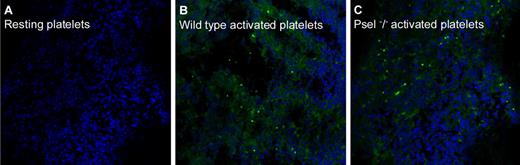 Figure 4. Spleen platelet accumulation. Fluorescent platelets from wild-type or from P-sel−/− mice were injected in the tail vein of wild-type synergic mice. Animals were killed 24 hours after platelet injection and their spleens retrieved, fixed, and included in optimal cutting temperature medium. Fluorescent platelets in the tissue were then revealed by confocal microscopy. See text for experimental details. (A) Mice injected with wild-type resting platelets. (B) Mice injected with wild-type activated platelets. (C) Mice injected with P-sel−/− activated platelets.