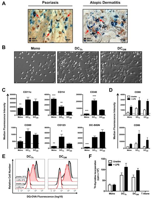 Figure 1. TH cells are juxtaposed with monocytes in inflamed skin and drive monocyte differentiation into DCs. (A) Representative skin lesions from psoriasis and atopic dermatitis patients were stained with antibodies against CD4 (brown) and CD14 (blue). Images are shown at 400× magnification and were acquired using the equipment described in “Immunohistochemistry.” Red arrows indicate potential monocyte/T cell interactions. Scale bar equals 20 μm. (B-F) CD14+ monocytes were cultured with IL-2 (Mono), autologous TH cells and IL-2 (DCTh), or GM-CSF and IL-4 (DCGM) for 6 days. (B) Hoffman modulation contrast microscopy shown at 400× magnification. Images were acquired using the equipment described in “Monocyte/T-cell cocultures.” Data are representative of > 10 donors. (C) Median fluorescence intensities (MFIs) of DC associated molecules are shown after excluding TH cells. Dashed lines indicate the average MFIs of isotype control Abs used for staining from all culture conditions. Data are from 4 independent experiments and > 10 donors (mean and SEM); *P < .05, **P < .01, ***P < .001 compared with DCGM. (D-F) On day 6, Mono, DCTh and DCGM were cultured for 36 hours in the presence (+ LPS) or absence (Unstim) of LPS. (D) MFIs of CD80 and CD86 are shown after excluding TH cells. Dashed lines indicate the average MFIs of isotype control Ab used for staining from all culture conditions. Data are from 2 independent experiments and 6 donors (mean and SEM). (E) Unstimulated (black histograms) and LPS-stimulated (red histograms) DCTh and DCGM were incubated with DQ-OVA for 30 minutes on ice (open histograms) or at 37°C (shaded histograms). DQ-OVA expression is shown after excluding TH cells. Data are representative of 2 independent experiments and 2 donors. (F) Allogeneic naive CD4+ T cells were cultured alone (T Alone) or with irradiated Mono, DCTh or DCGM with and without LPS stimulation at a 1:5 APC to T cell ratio in an MLR. After 6 days, 3H-thymidine was added for an additional 20 hours and T cell proliferation was assessed. Data are from 2 independent experiments and 5 donors (mean and SEM).