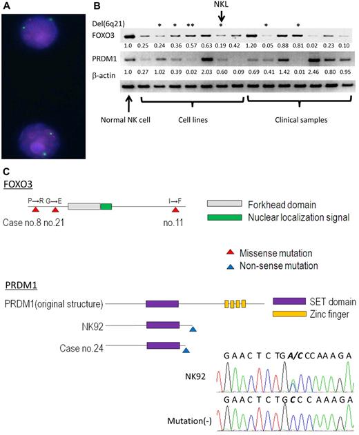 Figure 4. Expression and mutation analyses of FOXO3 and PRDM1. (A) FISH analysis of NKL. The red signal indicates the BAC probe 65306RP11-118H13 encompassing FOXO3, and the green signal indicates the centromere probe for chromosome 6 (CEP6, D6Z1; Abbott). The FOXO3 region shows heterogeneous loss. (B) PRDM1 and FOXO3 expression in NK-cell neoplasms (cell line and clinical samples). Semiquantitative RT-PCR was performed to validate the results of oligo-microarray analysis in 7 NK cell lines including NKL (from left; NKYS, SNK6, SNK10, HANK1, NK92, NKL, and KHYG1) and 7 clinical samples (from left; sample nos. 25, 27, 28, 30, 26, 31, and 32). Normal NK cells from one representative donor were also analyzed. Each band was converted to a numerical value using ImageJ software, and the ratio to β-actin was calculated. The ratio of normal NK cells and each neoplastic sample is shown below each band. *Samples with a 6q21 deletion; **HANK1 accompanied the deletion of PRDM1, but not FOXO3. (C) Mutation analysis of FOXO3 and PRDM1. The schema outlines the functional domain and location of the mutation. The mutation is shown as triangle on the map. The electrofluorogram shows that the mutation is located on exon 5 in NK92 and is aligned with the case without mutation. Missense mutations of FOXO3 were found in 3 cases and nonsense mutations of PRDM1 were found in 2 cases.