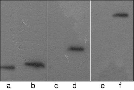 Figure 3. Demonstration of the trimeric complex of paratarg-7/PKCζ/PP2A by coimmunoprecipitation. Recombinant FLAG-tagged paratarg-7 expressed in HEK293 cells was precipitated using FLAG Abs (0.5 μg) and protein-G. The precipitate was subjected to PAGE followed by immunodetection with anti-FLAG (lanes a-b), anti-PP2A subunit C (lanes c-d) or anti-PKCζ (lanes e-f). As a negative control similarly expressed FLAG-tagged recombinant SMCHD1 protein was used. Lanes a, c, and e: control.