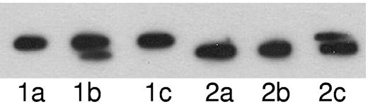 Figure 4. Complementation assays. Acceptor lysate derived from the LCLs of a patient carrying hyperphosphorylated paratarg-7 (lanes 1a-1c) or from LCLs of a healthy carrier of wild-type paratarg-7 (lanes 2a-2c) were incubated with lysate buffer as control (lane a) or with donor lysates derived from the LCLs of a healthy carrier of wild-type paratarg-7 (lane b), or with lysates derived from the LCLs of a patient carrying hyperphosphorylated paratarg-7 (lane c). After incubation (37°C, 48 hours), the samples were subjected to IEF followed by immunodetection of FLAG-tagged paratarg-7 using FLAG Abs. In lane 1b, dephosphorylation of hyperphosphorylated paratarg-7 was observed, while in lane 1c no dephosphorylation was detected, indicating a compromised dephosphorylation in carriers of hyperphosphorylated paratarg-7. In the reverse approach using wild-type FLAG-tagged paratarg-7 as acceptor and LCL extracts (lanes 2a-2c) as donors, the upper band representing hyperphosphorylated paratarg-7 was only detected when extracts derived from LCLs of the patient carrying hyperphosphorylated paratarg-7 were used as donors (lane 2c).