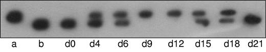 Figure 5. Induction of transient hyperphosphorylation of paratarg-7 in T-cells from healthy donors carrying wild-type paratarg-7. T cells were stimulated with anti-CD3 and anti-CD28 for 48 hours. IEF analysis followed by immunodetection of paratarg-7 was done after the indicated days of incubation (d0-d21). Unstimulated T-cell lysates from a patient carrying hyperphosphorylated paratarg-7 (lane a) or from a healthy donor carrying wild-type paratarg-7 (lane b) were used as control. Hyperphosphorylated paratarg-7 becomes detectable on day 4 and persists until day 18.