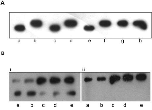 Figure 6. Identification of PP2A as the phosphatase responsible for the dephosphorylation of hyperphosphorylated paratarg-7. (A) Inhibition of phosphatases: LCLs derived from a healthy donor were cultured in the presence of inhibitors at indicated concentrations. Lysates were analyzed by IEF and stained with anti-paratarg-7. LCL lysates derived from a patient carrying hyperphosphorylated paratarg-7 (lane b) or from a healthy donor carrying wild-type paratarg-7 (lane a) and HEK293 cells (expressing wild-type paratarg-7, lane c) were used as controls. Incubation with serine/threonine phosphatase inhibitor cocktail 1 (Sigma-Aldrich; dilution 1:1000; lane d) and ocadaic acid (lane f, 500nM; lane g, 10nM; lane h, 0.1nM) inhibited the dephosphorylation resulting in the appearance of hyperphosphorylated paratarg-7. NIPP1 (10mM; lane e) had no effect. NIPP1 is a specific inhibitor of protein phosphatase 1 (PP1); ocadaic acid at 10nM inhibits both PP1 and PP2A, while at concentrations equal or below 0.1nM it inhibits only PP2A. (B) Analysis of PP2A subunit C derived from MM/MGUS patients and healthy donors: LCLs were subjected to IEF followed by immunodetection using PP2A subunit C Abs (1:1000; subpanel i) or pY307 specific Abs (1:1000; subpanel ii). The figure shows that in carriers of wild-type paratarg-7 (lanes a-b) the bottom band (representing the nonphosphorylated subunit) is dominant, while in patients carrying hyperphosphorylated paratarg-7 (lanes c-e) the upper band (representing the phosphorylated subunit) is dominant. Subpanel ii shows that the top band represents subunit C phosphorylated on Y307. Samples as in panel A.