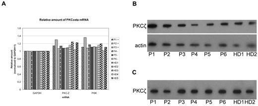 Figure 7. PKCζ expression in LCLs from different donors. The groups of donors were compared: MM/MGUS patients with (P1-P3) and without (P4-P6) paratarg-7 specificity of their paraprotein and healthy donors (HD1-HD5). (A) Quantitative RT-PCR for PKCζ, GAPDH, and PI3K was done as described. Values were normalized for GAPDH. (B) Immunodetection of PKCζ in 5 patients carrying hyperphosphorylated paratarg-7 (P1-5) and 2 healthy donors (HD1-2) carrying wild-type paratarg-7. (C) IEF analysis of these same samples.