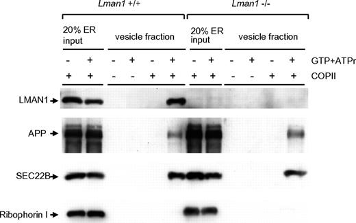 Figure 3. Budding of COPII-coated vesicles is not affected by LMAN1 deficiency. Semi-intact WT and Lman1−/− MEFs were permeabilized with digitonin and served as sources of the ER membranes. COPII proteins were supplied in rat liver cytosol. COPII-coated vesicles bud from the ER membrane with the addition of guanosine triphosphate and the adenosine triphosphate regeneration mix. The vesicles were purified by differential centrifugation and analyzed by Western blotting using the indicated antibodies.