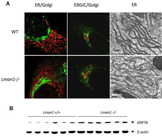 Figure 4. ER morphology and expression of UPR markers in WT (+/+) and Lman1−/− cells. (A) Color panels: Immunofluorescence staining of MEFs derived from WT and Lman1−/− embryos. MEFs were fixed in 4% paraformaldehyde, incubated with polyclonal antibodies against ER TRAPα for the ER (red), KDEL receptor for the ERGIC (green), and giantin for the cis-Golgi (green in the first panel, red in the second panel). Black-and-white panels: Morphology of rough ER was visualized by electron microscopy in WT and Lman1−/− hepatocytes. Scale bars represent 0.5μM. (B) Western blot analysis of GRP78 in liver lysates from WT and Lman1−/− mice using anti-KDEL antibody. Each lane contains a sample from a different individual mouse.