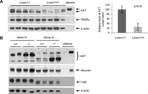 Figure 5. Plasma and liver AAT levels. (A) AAT antigen is increased in Lman1−/− mouse liver lysates. Liver lysates were prepared from WT and Lman1−/− mice and analyzed for AAT, TRAPα, and β-actin by immunoblotting. Relative levels of the lower band of AAT were quantified and normalized to β-actin. (B) AAT accumulates in the ER of Lman1−/− mouse liver. Liver lysates from WT and Lman1−/− mice were digested with endo H and analyzed for AAT, albumin, CatZ, and β-actin by immunoblotting. Each lane contains a sample from a different individual mouse.