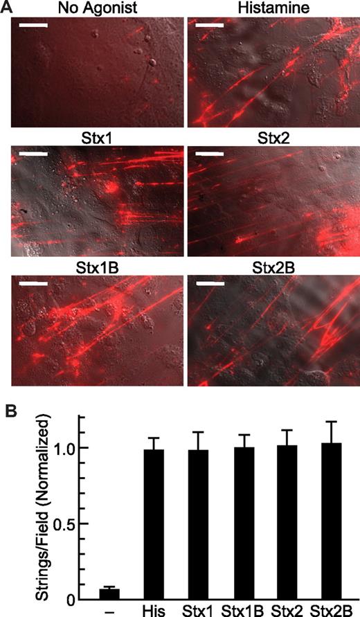 Figure 1. Stx holotoxin and StxB induced secretion of VWF. (A) HUVECs were perfused in a parallel plate flow chamber at 2.5 dyn/cm2 with medium M199 containing fluorescent anti-VWF antibody without or with 100μM histamine, 5nM Stx1, 5nM Stx2, 5nM Stx1B, or 5nM Stx2B and images were acquired at 10 minutes. Scale bars are 20 μm. Images were prepared with Photoshop CS4 (Adobe Systems). (B) VWF strings were counted in 10 fields and values shown as the mean ± SE, normalized to the mean value for Stx1B. Experiments were repeated at least 3 times with similar results.