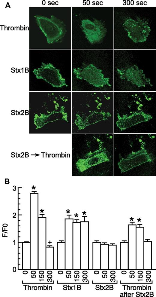 Figure 3. Stx1B-induced phosphatidylinositol-4,5 bisphosphate hydrolysis. (A) Confocal fluorescence images of cells expressing GFP-PH-PLCδ before (0 seconds) and after (50 and 300 seconds) treatment with 1 U/mL thrombin, 5nM Stx1B, 5nM Stx2B, or with thrombin after pretreatment with Stx2B for 300 seconds. Images were prepared with Photoshop CS4 (Adobe Systems). (B) Time course of cytoplasmic fluorescence changes relative to t = 0 (F/F0; data are means ± SE; *P < .01, +P < .05 relative to the initial condition).