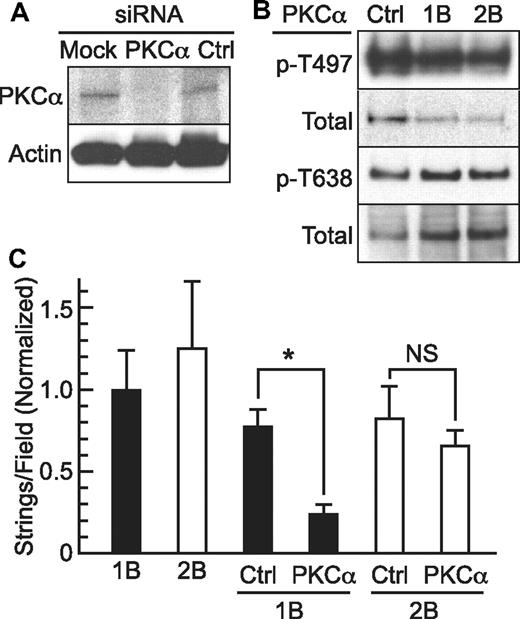 Figure 4. PKCα activation and Stx1B-induced VWF secretion. (A) HUVECS were transfected with PKCα siRNA or negative control siRNA oligonucleotides. Cell lysates were prepared after 72 hours and analyzed by 4%-12% SDS-PAGE and Western blotting to detect total PKCα and β-actin. (B) Secretion of VWF strings was assessed in HUVECs treated similarly. Values are shown as mean ± SE; *P < .00005 and NS indicates P = .4, by Student t test. (C) HUVECs were treated for 5 minutes with 5nM Stx1B or Stx2B, and cell lysates were prepared for 3%-8% SDS-PAGE and Western blotting with primary antibodies specific for PKCα phosphorylated on Thr638 or Ser497 and appropriate fluorescently labeled secondary antibodies. Blots were stripped and reprobed with antibody recognizing total PKCα.