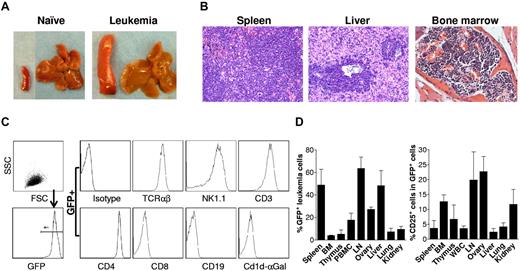 Figure 1. Development and characterization of GRKO leukemia. (A-B) Leukemia development in GRKO B6 mice receiving Notch1-overexpressing Lin−Sca1+ GRKO BMCs. Shown are representative spleen and liver tissues from naive and leukemia B6 mice (A) and histology (H&E) of spleen, liver and bone marrow from a representative leukemia mouse (B). (C) B6 mice were injected with leukemia cells (ie, splenocytes from mice receiving Lin−Sca1+ GRKO BMCs), killed when moribund, and GFP+ leukemia cells in the spleen were assessed by flow cytometry. Left panel indicates that the spleen consists of predominantly GFP+ leukemia cells; right panel shows the expression of various cell surface markers on gated GFP+ leukemia cells. (D) Naive B6 mice (n = 4) were injected intravenously with 5 × 106 cryopreserved GRKO leukemia cells and killed 2-3 weeks later for assessing leukemia development. Shown are percentages (mean ± SD) of GFP+ leukemia cells (left) and of CD25+ leukemia cells (right) in the indicated tissues.
