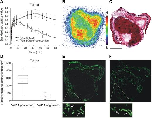 Figure 6. Siglec-9 peptide specifically targets VAP-1 in tumors. (A) Mean time-activity curves of 68Ga-DOTA peptide in a tumor xenograft obtained from PET imaging of wild-type mice (■) and after competition with excess of the unlabeled peptide (□). (B) A representative image of autoradiography (ie, distribution of radioactivity) in a tissue section and (C) H&E staining of the section. (D) Combined results from autoradiography analyses of 68Ga-DOTA peptide distribution in melanoma xenografts of 4 mice at 15 minutes after intravenous injection presented as photo-stimulated luminescence (mean ± SD). Radioactivity was analyzed in VAP-1–negative and –positive areas. (E) Immunohistochemical staining of the section of the same tumor as in panels B and C with antimouse VAP-1 antibody and (F) with anti–PV-1 antibody showing the blood vessels. Scale bar represents 2.5 mm for the whole tumor sections. Insets: Individual VAP-1– and PV-1–positive tumor vessels (arrows). For the autoradiography in panel B, cryosections of the tumor were thaw-mounted onto microscope slides and apposed to a phosphor imaging plate (Fuji Imaging Plate BASTR2025, Fuji Photo Film Co Ltd). After the exposure, the imaging plates were scanned with the FLA-5000 analyzer (Fuji Tokyo, Japan) to produce digitalized images. The images were analyzed using TINA Version 2.10f, Raytest Isotopenmessgeräte GmbH. Images for panels C,E and F were taken with Zeiss Axiovert 200M microscope using 5×/0.25 objective and Hamamatsu 1394 ORCA-ER camera. The software was AxioVision Version 4.5.