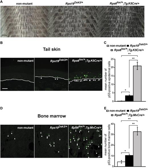 Figure 1. Effects of different ribosomal protein mutations on skin darkness and p53 levels. (A) Tails from nonmutant, Rps19Dsk3/+, and Rps6lox/+;Tg.K5Cre/+ animals. (B,D) Immunofluorescence for p53 in tail (B) and BM (D) sections from the ribosomal protein mutants. White lines (B) mark the dermal-epidermal junction; arrowheads mark p53-positive nuclei. (C,E) Quantitation of p53 immunostaining in the skin (C) and BM (E) of animals of the indicated genotype (n = 3-4 mice per group). Values are number of cells per high-power field (hpf) ± SEM (6 hpf per animal). P values are based on a 2-tailed t test, *P < .05, **P < .01; NS indicates not significant. Scale bars: 0.5 mm (A); 50μM (B,D).