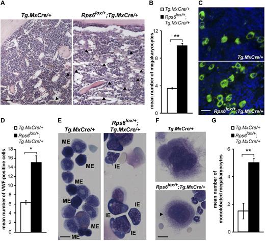 Figure 3. Effects of BM-specific Rps6 hemizygosity on BM histology and cytology. (A) Representative histologic sections from animals of the indicated genotype; arrowheads indicate megakaryocytes, quantitated in panel B (n = 3 animals per genotype, mean number of megakaryocyte per hpf is shown ± SEM, 8 hpf per animal). (C) Immunofluorescence staining for VWF (green) in BM sections counterstained with DAPI (blue) from nonmutant and ribosomal protein mutant animals and quantitated in panel D (n = 3 animals per genotype, mean number of VWF-positive cells with large nuclei per hpf is shown ± SEM, 10 hpf per animal). (E) Cytospin preparations show increased numbers of immature erythroid (IE) cells and decreased numbers of mature erythroid (ME) cells in mutant compared with control samples. (F) Example of normal and abnormal (a monolobated micromegakaryocyte, arrowhead) megakaryocyte morphology in cytospin preparations from nonmutant and mutant BM, quantitated (G) as mean number of monolobated cells among 10 megakaryocytes evaluated per animal ± SEM (n = 4-5 animals per genotype). P values are based on a 2-tailed t test, *P < .05, **P < .01; NS indicates not significant. Scale bars: 50μM (A); 75μM (C); 20μM (E); 10μM (F).