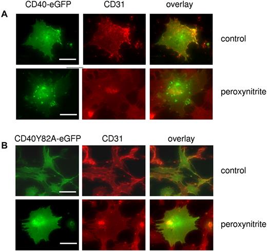 Figure 5. Nitration of Tyr-82 is crucial for peroxynitrite- induced internalization. (A) Effect of peroxynitrite (160μM, 1 hour) on the intracellular distribution of a CD40-eGFP hybrid protein expressed by a human endothelial cell line. Column 1, CD40-eGFP–positive cells (green); column 2, cells positive for the plasma membrane marker CD31 (red); and column 3, overlay of columns 1 and 2 with yellow fluorescence indicating localization of CD40 in the plasma membrane. The scale bar represents 10 μm. (B) Mutation of Tyr-82 to alanine abrogates translocation of the hybrid protein. Shown are representative fluorescent cells of at least 3 individual experiments each. The scale bar represents 20 μm (above) and 10 μm (below).