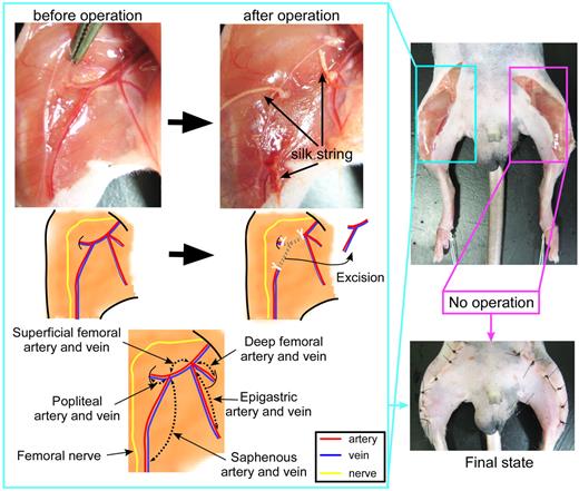Figure 1. Procedure for preparing the hemi-hind limb ischemic mouse model. On the right leg, we ligated the proximal end of the superficial femoral artery and vein, the origins of the popliteal artery and vein, and the distal portions of the saphenous artery and vein with surgical silk. All vessels surrounding the 3 ligated points were excised. The left leg was not treated, except for an incision in the skin of the thigh.