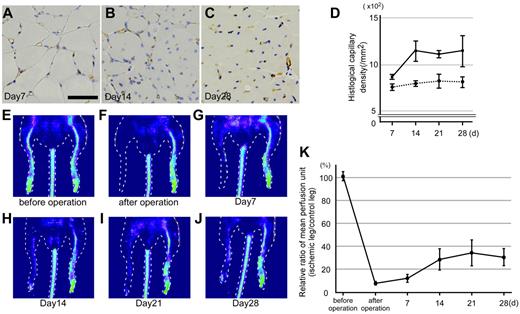 Figure 2. Evaluation of angiogenesis of the ischemic model mice. (A-C) Typical images of the gastrocnemius immunostained with an anti-CD31 antibody. The muscles from ischemic legs were isolated at 7, 14, and 28 days after the induction of ischemia and immunostained. Brown circles and dots represent CD31+ capillaries. Scale bar represents 50 μm. (D) Measurement of CD31+ capillary density. In the gastrocnemius of the ischemic or control leg, capillaries stained with the anti-CD31 antibody were counted. Solid and dotted lines represent the sample derived from ischemic and control legs, respectively. n = 4. Error bars represent SEM. (E-J) Changes in blood perfusion were assessed using laser Doppler perfusion imaging in ischemic legs of model mice. (E-F) Images before and soon after operation. After operation, the perfusion signal in the ischemic leg is significantly decreased. (G-J) Images from 7, 14, 21, and 28 days after operation. Blood perfusion in an ischemic leg gradually increases. (K) Change in perfusion units as determined by this imaging technique. Relative ratios of mean perfusion units between ischemic and control legs in the same mouse are shown (ischemic leg value/control leg value). n = 6. Error bars represent SEM.
