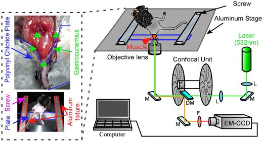 Figure 5. Schematic of the in vivo single-particle imaging system. An ischemic leg of a model mouse was stabilized on a polyvinyl plate using suture thread and instant Superglue. The skin and hemimembranous muscle were then removed. The gastrocnemius was selectively imaged using a single-particle imaging system.