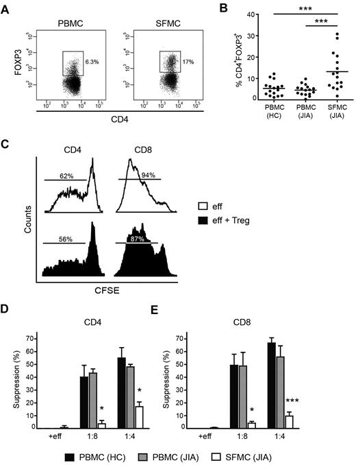 Figure 1. Treg-mediated suppression of T-cell proliferation is impaired at the site of autoimmune inflammation. (A-B) PBMCs and SFMCs were stained for CD4 and FOXP3 expression by flow cytometry. (A) Dotplots showing the percentage of FOXP3+ cells within CD4+ cells in paired PBMCs (left panel) and SFMC (right panel) of JIA patients, 1 representative of n = 16. (B) Accumulative data of the percentage of CD4+FOXP3+cells in PBMCs of HCs and paired PBMCs and SFMCs from JIA patients (n = 16), ***P < .001. (C-E) CD4+CD25+CD127low Tregs were sorted by flow cytometry and co-cultured with CFSE-labeled effector cells. At day 4, proliferation of CFSE+ effector cells was analyzed. (C) Proliferation of CD4+ (let panel) and CD8+ (right panel) SFMCs in the absence (open histograms) or presence of Tregs at 1 to 4 ratio (closed histograms). Percentages indicate the percentage of proliferating cells, 1 representative of n = 3. (D-E) Suppression of CD4+ (D) and CD8+ T-cell proliferation (E) in the presence of Tregs at a 1:8 and 1:4 ratio or additional effector cells (+eff) at a 1:4 ratio for PBMCs from HC (black bars), PBMCs from JIA patients (gray bars) and SFMCs from JIA patients (white bars). The results show percentage of suppression in the presence of Tregs or additional effector cells relative to effector cells cultured alone. Bars represent mean ± SEM of n = 6 PBMCs HCs, n = 2 PBMCs JIA, and n = 3 SFMCs JIA, *P < .05, ***P < .001 compared with PBMCs (HCs).