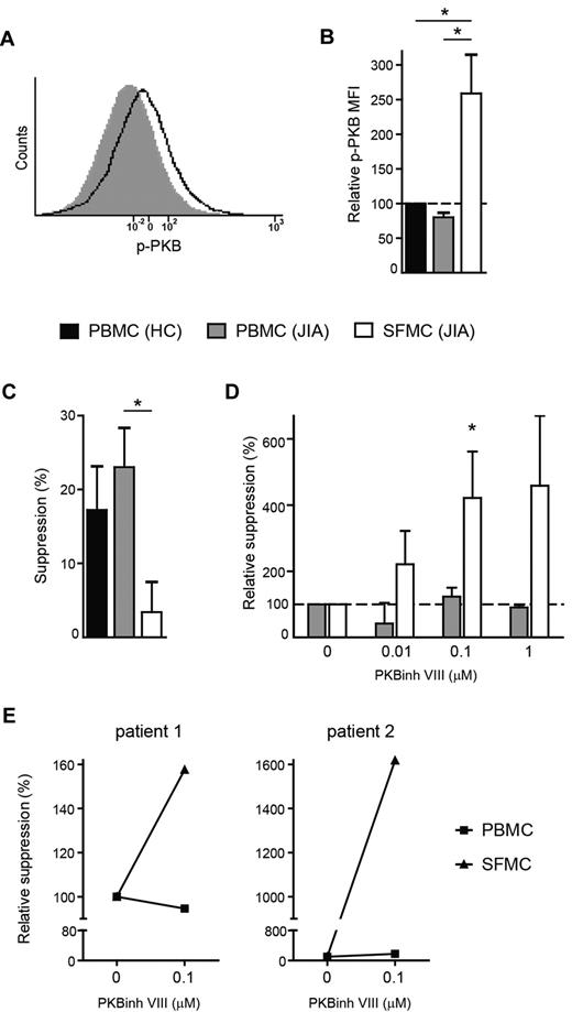 Figure 6. PKB/c-akt hyperactivation causes resistance of effector cells to suppression. (A-B) PBMCs and SFMCs were stained for phosphorylated PKB/c-akt expression by flow cytometry. (A) Histogram showing phosphorylated PKB/c-akt (p-PKB) fluorescence intensity in CD4+ T cells from paired PBMCs (solid gray) and SFMCs (black line), 1 representative of n = 3. (B) MFI of phosphorylated PKB/c-akt (p-PKB) in CD4+ T cells from paired PBMCs (gray bar) and SFMCs (white bar) of JIA patients relative to PBMC from HC (black bar). Bars represent mean ± SEM of n = 3, *P < .05. (C-D) CFSE-labeled PBMCs and SFMCs were cultured in the presence or absence of recombinant human TGFβ1 (40 ng/mL) and increasing concentrations of PKB/c-akt inhibitor VIII (PKBinh VIII; 0, 0.01, 0.1, 1μM). At day 5, proliferation of CD4+ T cells was analyzed. (C) TGFβ-mediated suppression of CD4+ T-cell proliferation for PBMCs from HCs (black bars) and PBMCs (gray bars) and SFMCs (white bars) from JIA patients. The results show percentage of suppression in the presence of TGFβ relative to cells cultured without TGFβ. Bars represent mean ± SEM of n = 3 PBMC HC, n = 4 PBMC JIA, and n = 5 SFMC JIA, *P < .05. (D) TGFβ-mediated suppression of CD4+ T cell proliferation for paired PBMCs (gray bars) and SFMCs (white bars) in the presence of increasing concentrations of PKB/c-akt inhibitor VIII. The data show the change in TGFβ-mediated suppression for each concentration of PKB/c-akt inhibitor relative to cultures without PKB/c-akt inhibitor. Bars represent mean ± SEM of n = 3, *P < .05 compared with 0μM PKB/c-akt inhibitor VIII. (E) CD4+CD25+CD127low Tregs were sorted from SFMCs by flow cytometry and cocultured with CFSE-labeled PBMCs (squares) or SFMCs (triangles) at a 1:4 ratio in the presence or absence of PKB/c-akt inhibitor VIII (PKBinh VIII) (0.1μM). At day 4, Treg-mediated suppression of CD4+ T-cell proliferation was analyzed. The data show the change in Treg- mediated suppression in the presence PKB/c-akt inhibitor relative to cultures without PKB/c-akt inhibitor.