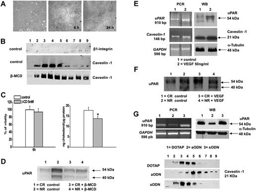 Figure 1. Relationship between caveolae and uPAR distribution in ECFC cell membrane. (A) Morphologic profile of ECFC colonies appeared after 2–3 weeks of culture (left panel). Capillary-morphogenesis in vitro at 6 and 24 hours (middle and right panel); (B) Caveolin-1 distribution. Cell lysates were layered on Optiprep solution and centrifuged as described in “Methods” to separate lipid rafts (fractions 2-6) from (fractions 7-9) in control conditions and after treatment with β-MCD (5mM for 20 minutes). Fractions obtained were probed by Western blotting with specific anti–caveolin-1 and anti-integrin β1 antibodies, as caveolar raft and nonraft marker respectively. Data are representative of 5 independent experiments. (C) β-MCD-treatment: right panel shows the β-MCD-induced cholesterol depletion. Evaluation of cholesterol amount was performed as previously described22; left panel shows vitality of the β-MCD-treated cells determined by trypan blue dye exclusion test. *P < .05, significantly different from control; (D) uPAR distribution: control and β-MCD–treated cells were subjected to Optiprep gradient separation and caveolar raft (CR) and nonraft (NR) fractions were analyzed by Western blotting with anti-uPAR antibody M2, which reveals both the full length and truncated uPAR. Numbers on the right indicates molecular weights expressed in kilodaltons. Data are representative of 5 independent experiments performed with clones expressing different levels of uPAR; (E) VEGF treatment: expression of uPAR and caveolin-1. Left panels: PCR of uPAR and caveolin-1 cDNA in untreated (control; lane 1) and VEGF-treated (lane 2) ECFCs. Numbers on the left indicate the size of PCR products in base pairs (bp). GAPDH: glyceraldehyde-3-phosphate dehydrogenase used as housekeeping gene. Right panels show Western blotting for uPAR and caveolin-1. Numbers on the right indicate molecular weights expressed in kilodaltons; (F) uPAR distribution in control and in VEGF-treated ECFCs. Control and VEGF-treated cells were subjected to Optiprep gradient separation: caveolar raft (CR) and nonraft (NR) fractions were collected and analyzed by Western blotting with anti-uPAR antibody M2. Numbers on the right indicate molecular weights expressed in kilodaltons; (G) silencing of uPAR gene using anti-uPAR aODNs: cell cultures were treated with aODN for 4 days in the presence of the cationic phospholipid DOTAP. A scrambled ODN (sODN) was used as a negative control. Top panels: PCR of ODNs-treated cells (on the left); Western blotting of ODNs-treated cells (α-tubulin was used as a loading control; on the right). Bottom panels: distribution of caveolin in Optiprep-prepared caveolar rafts after ODNs treatment. Data shown in panels E, F, and G are representative of 5 independent experiments.