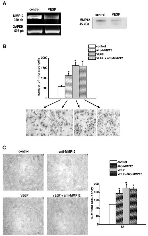 Figure 6. In vitro MMP12-dependent angiogenesis. (A) Left panel: RT-PCR of MMP12 in control and VEGF-treated ECFCs. Right panel: Western blot analysis of MMP12 revealed in the culture medium of control and VEGF-treated ECFCs. (B) Matrigel invasion of control and VEGF-treated ECFCs, in the absence and in the presence of anti-MMP12 antibody (10 μg/mL), under basal conditions (control), and after VEGF stimulation. Histogram refers to quantification of Matrigel invasion assay obtained by counting the total number of migrated cells/filter. Results are the mean of 3 different experiments performed in triplicate in 3 ECFC preparations and are shown as mean value ± SD. *P < .05, significantly different from control. (C) Capillary morphogenesis of ECFCs using the same experimental conditions described for panel B. The figures are representative of a typical experiment of 3 experiments performed in triplicate in 3 ECFC preparations. Quantification was performed by measuring the percentage field occupancy of capillary projections, taking the control as 100%. *P < .05, significantly different from control. Image acquisition and quantification were performed as described in Figures 1 and 3.