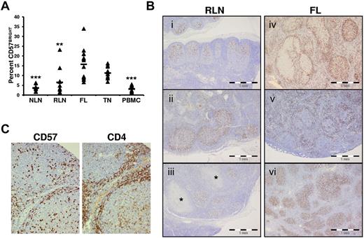 Figure 4. Increased proportions and altered anatomical localization of CD57+ T cells in FL. (A) Proportions of CD57BRIGHT CD4+ T cells in the indicated tissue are expressed as the percentage of the total CD4+ T cells. Triangles represent values for individual samples, and rectangles represent averages for each tissue type expressed as a percentage of the total CD4+ T cells. *P < .05, **P < .01, and ***P < .001 compared with FL. (B) ICH analysis of CD57+ cells within RLNs and FL. In RLNs, CD57+ cells are highly restricted to the GC and show polarization, with a relative abundance in the LZ (Bi-iii). This stereotypic distribution was seen in 10 of 10 RLN specimens, even when the node showed other features of inflammation such as necrotizing granulomata (* in Biii). In contrast, the distribution of CD57+ cells varied widely among FL specimens. Random microscope fields were selected (original magnification, ×100) from 20 cases of FL, and the location of 200 CD57+ cells was noted as either follicular or otherwise. Three of 20 cases had more than three-quarters of the CD57+ cells within follicles (Bvi), 11 of 20 showed more than three-quarters of CD57+ cells outside follicles (Bv, in which the CD57+ cells appear associated with a mantle zone), and 6 of 20 showed a mixed distribution of cells (Biv). (C) IHC analysis of CD57 and CD4 shows CD57+ cells colocalized to areas of CD4+ cells in a FL nodal section.