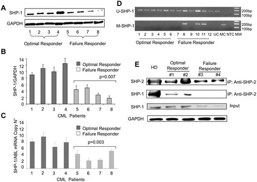Figure 6. Evaluation of SHP-1 expression at protein level in patients with CML. (A) SHP-1 expression is assessed by WB analysis in patients with CML. Protein lysates of BM aspirates derived from 4 patients classified as failure responders and 4 optimal responders are separated on 10% SDS-PAGE and immunoblotted with Ab-SHP-1. GAPDH is used as protein loading control. (B) Densitometric analysis of the SHP-1 immunoblot shown in panel A. Failure responder patients express a significant lower amount of SHP-1 protein expression compared with optimal responders (P = .007). (C) SHP-1 mRNA expression level assessed by RT-qPCR in the same patients with CML analyzed in panels A-B. Failure responder patients express a significant lower amount of SHP-1 mRNA compared with optimal responders (P = .003). (D) MSP analysis done on SHP-1 promoter region of patients with CML (1-6 = optimal responders; 7-12 = failure responders). Each sample is amplified by methylated primers (M) or unmethylated primers (U). NTC indicates nontemplate control; MC, methylated control; UC, unmethylated control; MW, marker of molecular weight. (E) Anti–SHP-2 IP analysis in CD34+ cells derived from 2 optimal responder and 2 failure responder patients. Protein lysates were normalized by GAPDH staining before IP experiments. (Top) Control immunoblot of IP lysates by staining with Ab–SHP-2; (middle) anti–SHP-1 immunoblot; total lysates are analyzed for the presence of SHP-1 protein by immunoblot with Ab–SHP-1 (bottom).