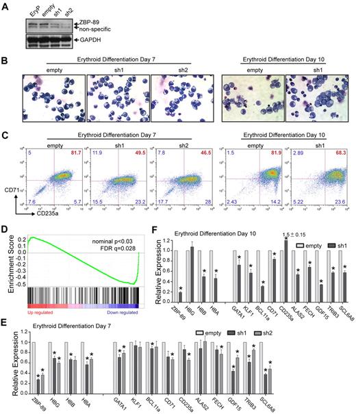 Figure 5. Requirement for ZBP-89 in human globin gene activation and erythroid maturation. (A) Lentiviral-mediated shRNA knockdown of ZBP-89 in ex vivo differentiated erythroid precursors. Western blot for ZBP-89 protein levels in nontransduced erythroid precursors (EryP), or those transduced with the empty lentiviral vector or vectors containing one of 2 shRNA constructs (sh1 and sh2) that target different sequences within ZBP-89 exon 9 (“shRNA knockdown”). Western blot was performed from cells harvested on day 7 after placement into differentiation medium. (B) May-Grunwald-Giemsa stains of cytospun EryP cells transduced with the empty vector, sh1 or sh2 on days 7 and 10 of differentiation (original magnification × 600; see supplemental Figure 2 for additional images). (C) Flow cytometric analysis for CD71 and CD235a expression of EryP cells transduced with the empty vector, sh1, or sh2 on days 7 and 10 of differentiation. (D) Gene Set Enrichment Analysis of genes differentially expressed on ZBP-89 knockdown (sh1; vs the empty vector) on day 6 of differentiation compared with the erythroid-specific expressed gene set.23 The y-axis shows the enrichment score for each gene, which is illustrated as a vertical line plotted in rank order of most up regulated (left) to most down-regulated (right). (E-F) Quantitative RT-PCR analysis of mRNA transcript levels for the indicated genes in EryP cells transduced with the empty vector, sh1, or sh2 on day 7 (E) and day 10 (F) of differentiation. Expression is shown relative to levels from the empty vector-transduced cells and is normalized to Gapdh levels. Measurements represent the mean from > 3 independent experiments ± SEM. *Significant differences compared with the empty vector (P < .05, Student t test).