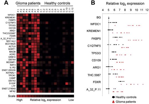 Figure 2. Glioma-associated gene expression signature. (A) Platelet RNA from glioma patients and healthy control subjects was subjected to gene-expression arrays. SAM analysis was used to determine significantly expressed genes. A heatmap of the top-30 up-regulated RNAs is shown. (B) Individual expression levels for the top-10 RNAs. Dashed line indicates background (BG).