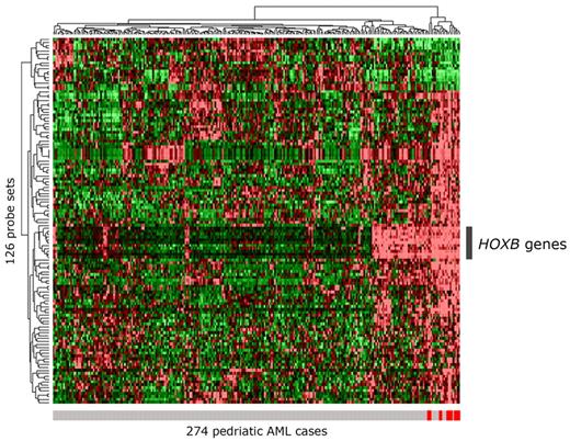 Figure 6. Clustering of 274 pediatric AML cases based on the 126 most discriminative probe sets for NUP98/NSD1. Hierarchical clustering of 274 pediatric AML cases based on the 126 most discriminative probe sets (FDR-adjusted P value < .05) for NUP98/NSD1 AML is presented in a heat map. The 13 NUP98/NSD1 cases are indicated with a red vertical bar below the heat map; the other AML cases are indicated with a gray vertical bar. In the heat map, cells represent relative log 2 expression values and have been color-coded on a scale ranging from bright green (−2) to bright red (+2), with black indicating no change relative to the median. Besides clustering of the NUP98/NSD1 cases, a group of other AML cases show a partly similar gene expression profile mainly based on the highly expressed HOXB probe sets, indicated by the gray bar at the right of the heat map.