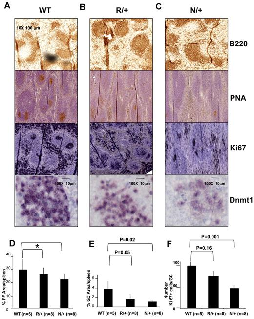 Figure 4. GC formation is impaired in Dnmt1 hypomorphic mice. (A-C) C57BL/6 wild type (WT; A), or Dnmt1 R/+ (B) and Dnmt1 N/+ (C) were immunized with SRBC to induce GC formation. Animals were killed on day 10 and formalin fixed paraffin embedded splenic tissue was stained with anti-B220, PNA, anti-Ki67, and anti-Dnmt1. (D) Quantitative imaging of spleen tissue based on immunohistochemistry staining from Figure 3A revealed no significant difference in the size of primary follicles (*P = .18 and .52, t test), but decreased size of the GCs (E) and the number of proliferating cells per GC (ki67) in the Dnmt1 hypomorph animals (F). The numbers of animals per condition are shown in parenthesis.