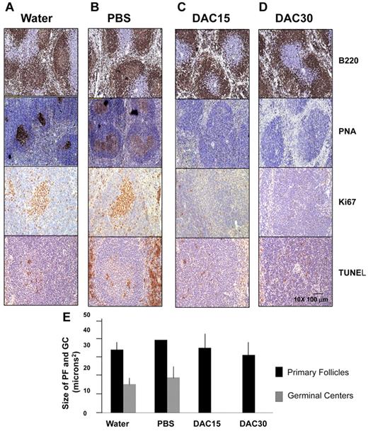 Figure 6. Decitabine treatment abrogates formation of GCs in mice. Twenty C57/BL6 mice were immunized with SRBCs and subjected to daily intraperitoneal injections of water (A), PBS solution (ie, vehicle, B), 15 mg/m2 decitabine (C) or 30 mg/m2 decitabine (D). Formalin fixed paraffin embedded splenic tissue recovered at day 10 was examined by immunohistochemistry for B220, PNA, Ki67 and TUNEL. (E) The histogram represents the quantitative assessment of primary follicle and GC size as assessed by immunohistochemistry staining in all animals.