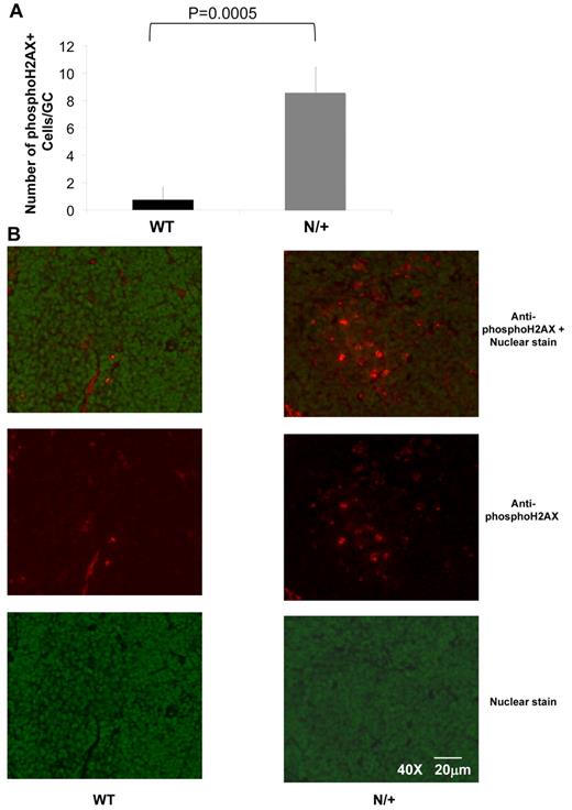 Figure 7. Increased H2AX phosphorylation in the GCs of Dnmt1 hypomorphic mice. (A) The number of phosphoH2AX positive cells per GC was counted in WT or Dnmt1N/+ mice at day 10 after immunization with SRBC based on immunofluorescent staining of splenic sections (B) Representative images from the immunofluorescent staining of WT and Dnmt1N/+ hypomorphic mice using a nuclear stain (green) and anti-phosphoH2AX monoclonal antibody (red), (top: overlay; middle: anti-phosphoH2AX antibody; and bottom: nuclear stain only).
