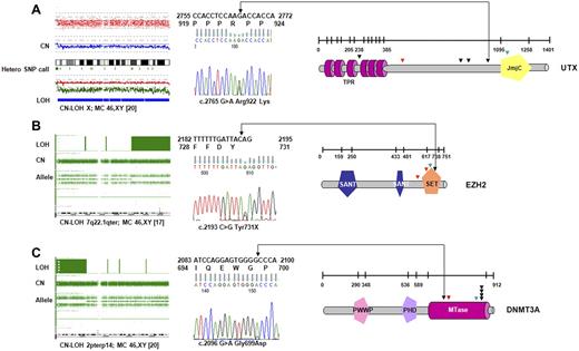 Figure 2. UTX, EZH2, and DNMT3A mutations identified in CMML. (A) In a cohort of 72 patients with CMML and AML-derived CMML, 2 somatic, inactivating UTX mutations were detected by sequencing. Four additional missense variants that could correspond to rare polymorphisms were identified. Profile of CN-LOH of X chromosome by SNP-A in one male patient with a UTX missense variant. Mutations/variants are denoted and relative to the UTX sequence NM_021140.1. The location of the TRP (tetratrico peptide repeat region) and JmjC (Jumonji C) domains is shown. (B) Identification of variations in EZH2-domain structure and positions of mutations in patients. All mutations were found in the SET domain or in close proximity. In 3 subjects mutations were identified along with CN-LOH7q encompassing EZH2 as shown for representative patient (SET indicates suppressor of variegation 3-9, enhancer of zeste and trithorax domain; SANT-DNA–binding domain in the SWI-SNF and ADA complexes, the transcriptional co-repressor N-CoR and TFIIIB). (C) Mutations identified in methyltransferase domain of DNMT3A in 7 patients with CMML and AML-derived CMML. Homozygous DNMT3A mutations were associated with CN-LOH2p involving DNMT3A. The location of the PWWP (a highly conserved proline-tryptophan-tryptophan-proline motif), PHD (plant homeodomain finger, a zinc-fingerlike motif), and MTase (methyltransferase) domains is shown. Missense mutations are indicated by black; frameshift by red, and nonsense mutations by green arrows.