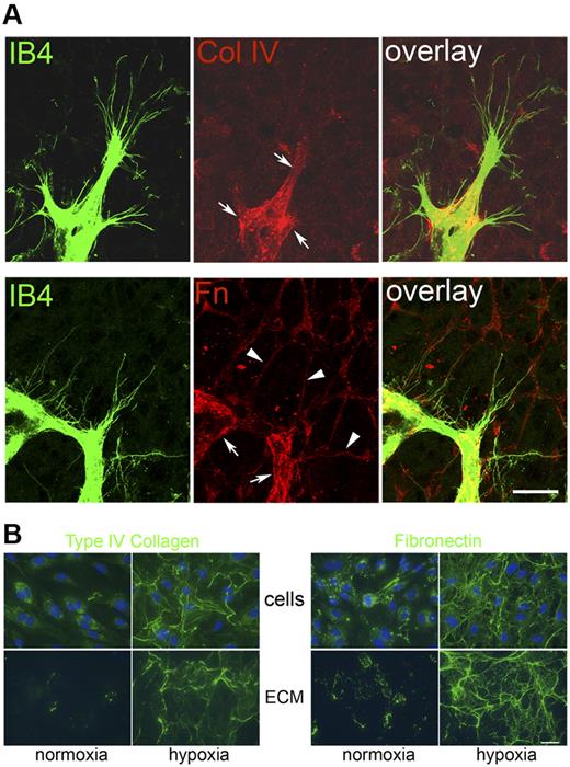 Figure 1. Hypoxia-induced deposition of collagen IV and fibronectin in endothelial ECM. (A) Whole mount immunofluorescence of P5 mouse retina was performed for detection of collagen IV (Col IV) and fibronectin (Fn). ECs were stained with isolectin B4 (IB4). Images correspond to the projection of 6 confocal sections at the vascular front. Arrows indicate sites of deposition of collagen IV and fibronectin by tip cells in the basement membrane. Arrowheads indicate the fibronectin network in the avascular zone. Bar: 20 μm. (B) HUVECs were cultured in normoxia or hypoxia for 5 days. Immunofluorescence of collagen IV (left panel) and fibronectin (right panel) was performed on either whole cell layer (cells) or ECM after detaching cells (ECM). Nuclei were stained with DAPI. Bar: 30 μm. See also supplemental Figure 1.