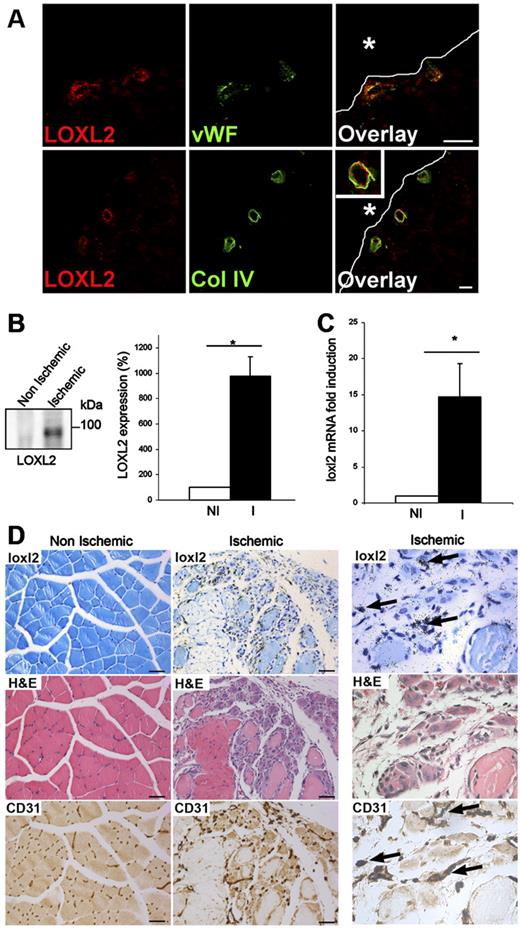 Figure 3. LOXL2 is expressed by ECs in developmental and pathologic angiogenesis. (A) Immunofluorescence was performed on cryosections of P6 rat eye for detection of LOXL2 and either von Willebrand factor (VWF) or collagen IV (Col IV). Vitreous humor is indicated by asterisks and white lines. Bar: 20 μm. (B-D) Unilateral critical ischemia (I: ischemic) was analyzed 6 days postsurgery, using contralateral hindlimb as control (NI: non ischemic). (B) Fifty micrograms of total protein extracts were subjected to immunoblotting of LOXL2 (left panel). LOXL2 amount was quantified in extracts from 3 mice (right panel). Results are represented ± SD. (C) Quantification of loxl2 mRNA induction by real-time quantitative PCR. For each mouse (n = 3), actin was used as control. Mean relative induction in ischemic muscle (I) is represented ± SD. (D) In situ hybridization of loxl2 mRNA was performed on sections of non ischemic or ischemic tibialis anterior muscle (top lane). Slides were counterstained with toluidine blue. Serial sections were stained with H&E (middle lane), and CD31 was immunostained (bottom lane). Arrows indicate colocalization of loxl2 and CD31 in high magnification images (right panel). Bar: 200 μm. See also supplemental Figure 4.