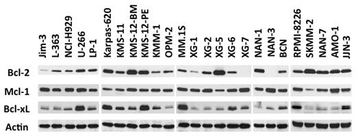 Figure 1. An HMCL subgroup highly expresses Bcl-2 and Bcl-xL. Immunoblot analysis of 25 HMCL lysates (70 μg of protein) with the indicated antibodies. Actin was used as a loading control.