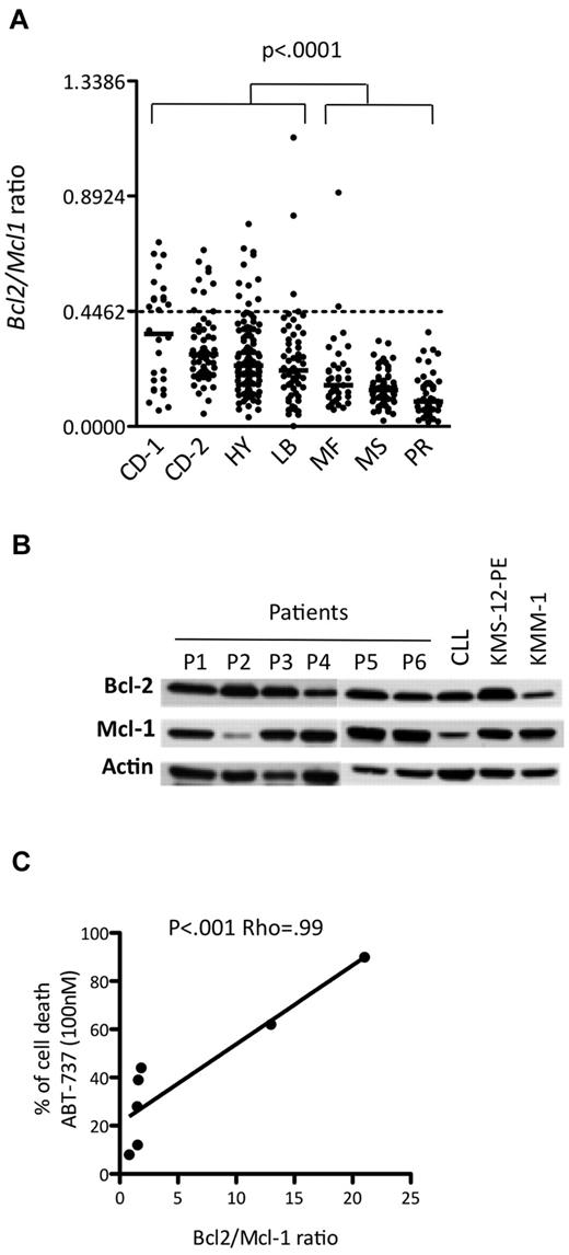 Figure 3. ABT-737 is efficient against a subset of primary myeloma cells. (A) Affymetrix gene expression profiles of purified myeloma cells from 414 newly diagnosed patients, publicly available from the Arkansas Cancer Research Center. The ratio of BCL2 to MCL1 is indicated for each patient in the different molecular groups classified according to Zhan et al5 as follows: CCND1-1 (CD-1), CCND1-2 (CD-2), hyperdiploid (HY), low bone disease (LB), MAF (MF), MMSET (MS), and proliferation (PR). (B) Western blot analysis of Bcl-2 and Mcl-1 expression in CD138+ purified primary MM cells. A sensitive HMCL (KMS-12-PE) and a resistant HMCL (KMM-1) as well as a CLL sample were included in the panel as controls. Actin was used as a loading control. (C) Analysis of primary myeloma cell sensitivity to ABT-737 (100nM) in function of Bcl-2/Mcl-1 ratio. The Spearman rank correlation coefficient is indicated.